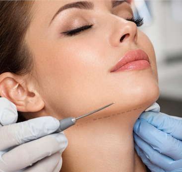 Липосакция подбородка